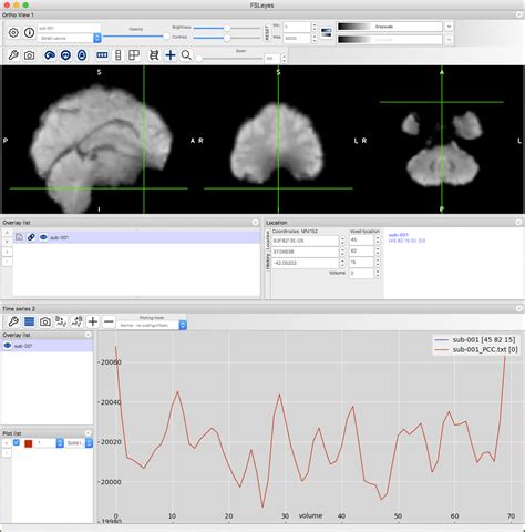 fsl bet|fsl fmri tutorial.